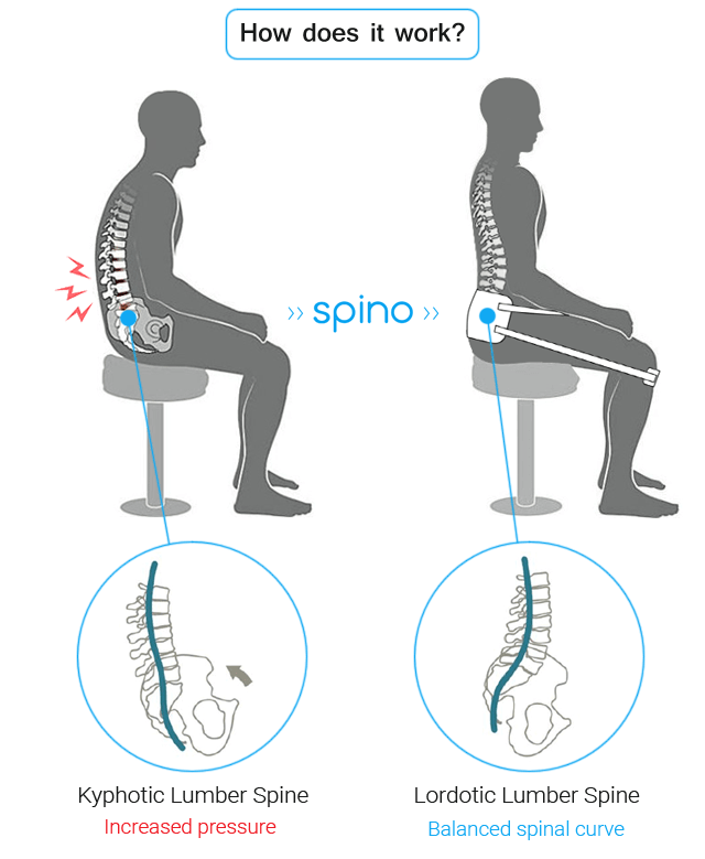 Spino - Simple Solution for a Healthy Back | Indiegogo